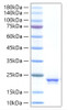 Recombinant Human IFN-alpha 21 Protein (RPCB1412)