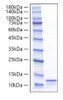 Recombinant Mouse CCL17/TARC Protein (RPCB1413)