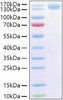 Recombinant Human P-Selectin/SELP/CD62P Protein (RPCB1415)
