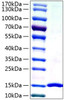 Recombinant Human Galectin-7/LGALS7 Protein (RPCB1418)