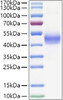 Recombinant Human TGFR-1/ALK-5 Protein (RPCB1424)
