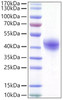 Recombinant Human DC-SIGN/CD209 Protein (RPCB1439)