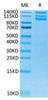 Recombinant Human ITGAV/CD51&ITGB3/CD61 Protein (RPCB1444)
