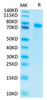 Recombinant Human Notch 1 Protein (RPCB1457)