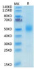 Recombinant Mouse GFR alpha-like/GFRAL Protein (RPCB1464)