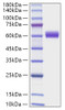 Recombinant Mouse Angiotensinogen/AGT Protein (RPCB1474)