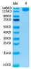 Recombinant SARS-COV-2 Spike S1 Protein (RPCB1479)