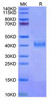 Recombinant Cynomolgus IL-2RB/CD122 Protein (RPCB1481)