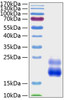 Recombinant Human IGFBP-8/CTGF Protein (RPCB1493)