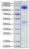 Recombinant Human Insulin Receptor/INSR/CD220 Protein (RPCB1498)