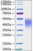Recombinant Mouse TIM-3/HAVCR2/CD366 Protein (RPCB1501)