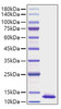 Recombinant Human CXCL2/MIP-2 Protein (RPCB1504)