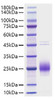 Recombinant Human Chorionic Gonadotropin/CGA Protein (RPCB1505)