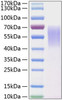 Recombinant Human LYPD3 Protein (RPCB1508)