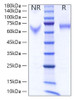 Recombinant Human IL-12/IL-12A&IL-12B Protein (RPCB1510)