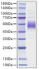 Recombinant Mouse SIRPB1A Protein (RPCB1512)