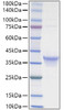 Recombinant Human IL-34 Protein (RPCB1520)