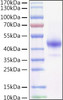 Recombinant Mouse TNFRSF13C/BAFFR/CD268 Protein (RPCB1531)