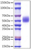 Recombinant Mouse c-Kit/CD117 Protein (RPCB1534)