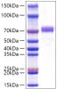 Recombinant Human GOLPH2/GOLM1 Protein (RPCB1535)