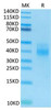 Recombinant Human NKG2A&KLRD1/CD159a&CD94 Protein (RPCB1539)
