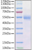 Recombinant Human Frizzled-2/FZD2 Protein (RPCB1548)