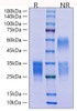 Recombinant Mouse CD69 Protein (RPCB1555)