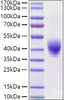 Recombinant Rat TROP-2/TACSTD2 Protein (RPCB1568)