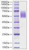 Recombinant Human Microtubule-associated protein tau/MAPT Protein (RPCB1574)