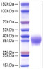 Recombinant Mouse Fc gamma RIIB/FCGR2B/CD32b Protein (RPCB1577)