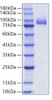 Recombinant Human Siglec-6/CD327 Protein (RPCB1591)