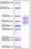 Recombinant Human MITF Protein (RPCB1606)