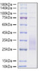 Recombinant Mouse TREM2 Protein (RPCB1621)