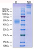 Recombinant Mouse ICOS/CD278 Protein (RPCB1623)