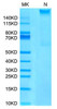 Recombinant Human MAGE-A4 (HLA-A*02:01) Complex Tetramer Protein (RPCB1625)