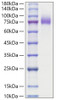 Recombinant Human MUC-16/CA125 Protein (RPCB1630)