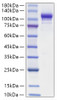 Recombinant Mouse Autotaxin/E-NPP2 Protein (RPCB1652)