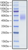 Recombinant Human CRTAM/CD355 (A65V) Protein (RPCB1664)
