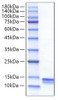 Recombinant Mouse CCL4/MIP-1Î² Protein (RPCB1675)