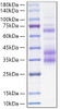 Recombinant Mouse Clusterin/Apo-J/CLU Protein (RPCB1676)