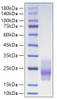 Recombinant Human CD63 Protein (RPCB1683)