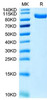 Recombinant Human PTK7/CCK4 Protein (RPCB1689)