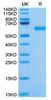 Recombinant Mouse ROR1 Protein (RPCB1690)