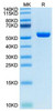 Recombinant Human P53 R175H (HLA-A*02:01) Complex Protein (RPCB1696)
