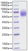 Recombinant Mouse Thrombopoietin/THPO Protein (RPCB1698)
