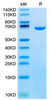 Recombinant Mouse Serum albumin/ALB Protein (RPCB1709)