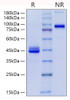 Recombinant Human CD9 Protein (RPCB1711)