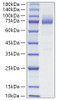 Recombinant Mouse SR-B3/CD36 Protein (RPCB1714)