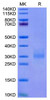 Recombinant Cynomolgus NKG2A&KLRD1/CD159a&CD94 Protein (RPCB1739)