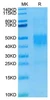 Recombinant Human NKG2C/KLRC2/CD159c Protein (RPCB1748)